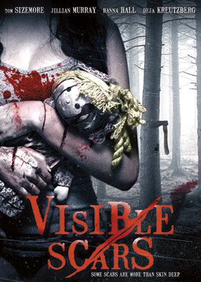 visible-scars