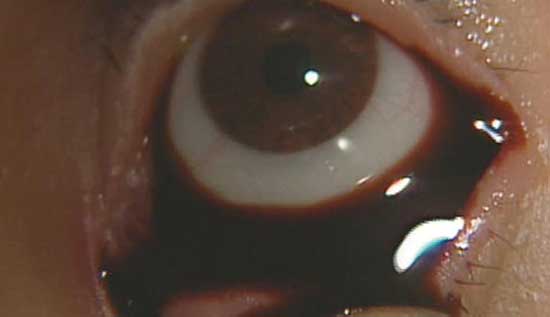 Top 10 Most Disturbing Horror Movies Of All Time Guinea-Pig-Flower-Of-Flesh-And-Blood-eye